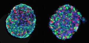 Islet cells from human donors