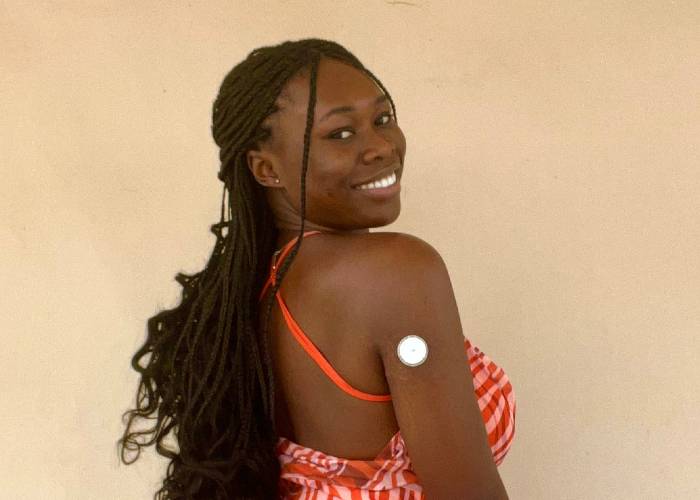 Temi Olonisakin smiling at the camera over her shoulder with her continuous glucose monitor visible.