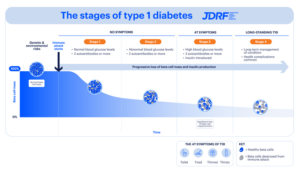 A blue infographic explaining the stages of type 1 diabetes.