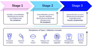 T1D develops in stages over time. This chart explains the different stages of T1D and the symptoms that people should be aware of.