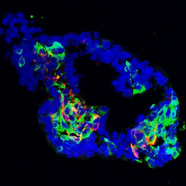 Beta cells made in a lab from stem cells.
