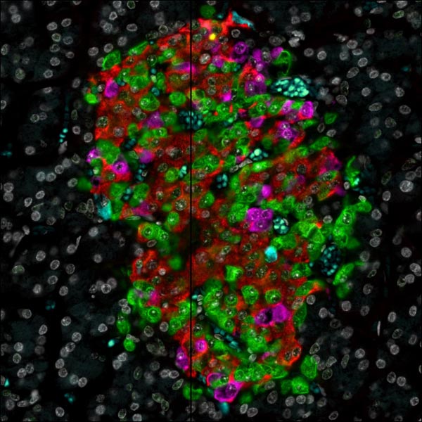 Staind islet cells in the pancreas under a microscope